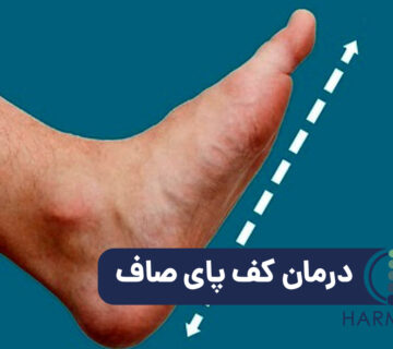 کف پای صاف 1 360x320