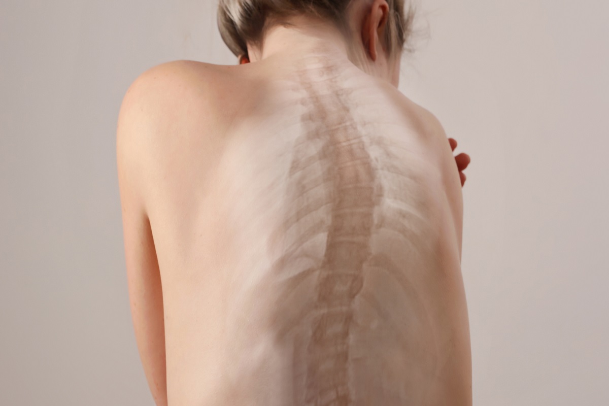 حرکات اصلاحی قوز کمر برای پیشگیری از آرتروز گردن و درد شانه