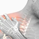 شانه یخ زده