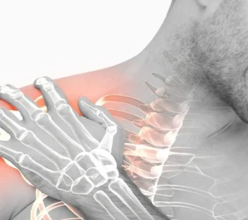 شانه یخ زده